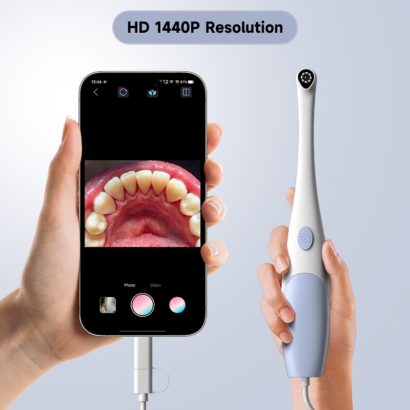 Oral Endoscope Camera 1440P Ph - Photography Lighting Handheld 评论和价格
