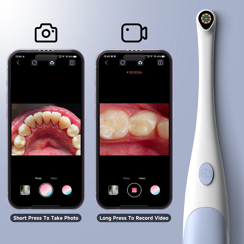 Oral Endoscope Camera 1440P Ph - Photography Lighting Handheld 评论和价格